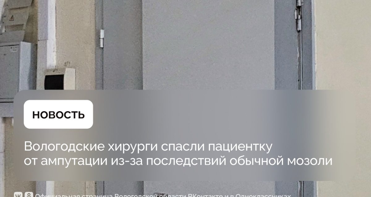 Врачи спасли ногу 62-летней вологжанке с диабетом после запущенной мозоли